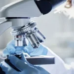 China develops diagnostic kit for early detection of lung cancer